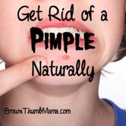 6 Ways to Get Rid of a Pimple, Naturally: BrownThumbMama.com